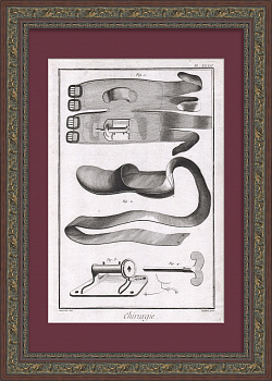 Хирургия: лечение Ахиллова сухожилия. Уникальная гравюра 18 века