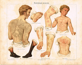 Гравюра "Кожные болезни"