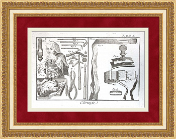 Трепанация черепа, нейрохирургия в 18 веке. Уникальная, старинная гравюра