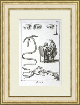 Хирургия глаза. Офтальмология в 18 веке, уникальная гравюра